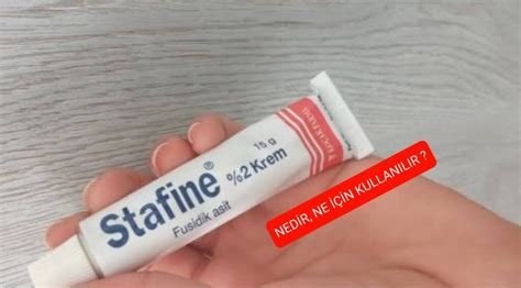 Stafine Krem Yanık İçin Kullanılır mı? Ürün Deneyimleri Stafine Krem Yanık İçin Kullanılır mı? Ürün Deneyimleri