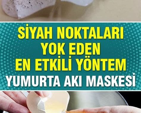 Yanık İçin Yumurta Akı Zeytinyağı: Doğal Alternatif Yöntem Yanık İçin Yumurta Akı Zeytinyağı: Doğal Alternatif Yöntem