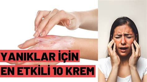 Yanık İzi Kalmaması İçin Hangi Krem Kullanılmalı? Yanık İzi Kalmaması İçin Hangi Krem Kullanılmalı?