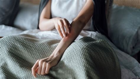 Yanık Kaşıntısı: Neden Olur ve Nasıl Geçer? Yanık Kaşıntısı: Neden Olur ve Nasıl Geçer?