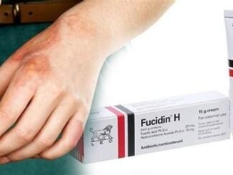 Yanık Kremi Fucidin: Kullanımı ve Faydaları