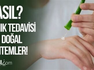 Yanık Nasıl Geçer? Evde Uygulanabilecek Yöntemler