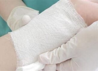 Yanık Tedavisi Nasıl Olmalı? Doğru Tedavi Yaklaşımları