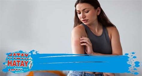 Yanık Tedavisine Ne İyi Gelir? İyileştirici Tavsiyeler Yanık Tedavisine Ne İyi Gelir? İyileştirici Tavsiyeler