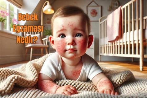 Asit Yanıkları: Belirtileri, Riskleri ve Etkili İlk Yardım Yöntemleri Asit Yanıkları: Belirtileri, Riskleri ve Etkili İlk Yardım Yöntemleri