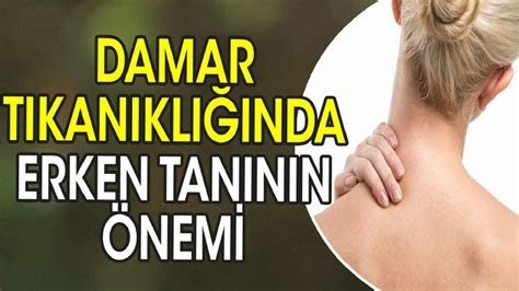 Radyasyon Yanıklarında Uzman Görüşleri ve Tedavi Planları Radyasyon Yanıklarında Uzman Görüşleri ve Tedavi Planları
