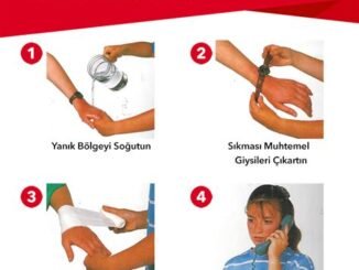 Yanık Tedavisinde İlk Yardım Protokollerinde Sık Yapılan Hataların Düzeltici Yöntemleri