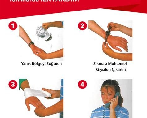 Yanık Tedavisinde İlk Yardım Protokollerinde Sık Yapılan Hataların Düzeltici Yöntemleri Yanık Tedavisinde İlk Yardım Protokollerinde Sık Yapılan Hataların Düzeltici Yöntemleri