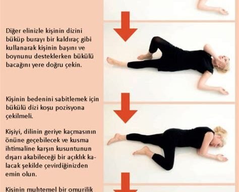 Yanık Türlerinde İlk Yardımda Doğru Olan Uygulamaları Adım Adım Anlatan Rehber Yanık Türlerinde İlk Yardımda Doğru Olan Uygulamaları Adım Adım Anlatan Rehber