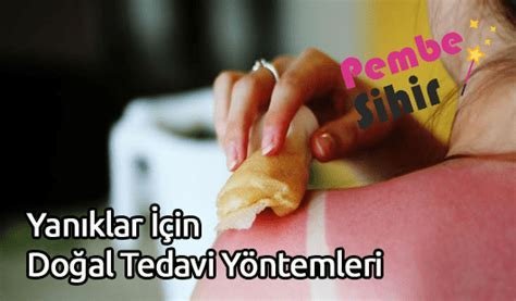 Yanıklar ve Doğal Tedavi Yöntemleri: Uzman Tavsiyeleri Yanıklar ve Doğal Tedavi Yöntemleri: Uzman Tavsiyeleri